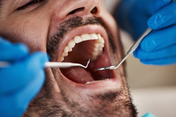 Best Oral Cancer Screening  in Centerfield, UT